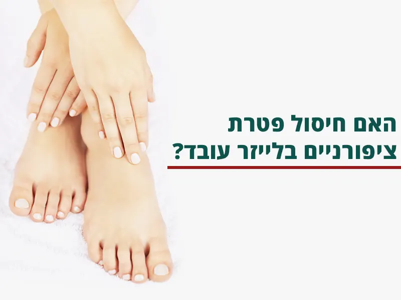 חיסול פטרת ציפורניים בלייזר